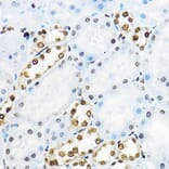 Immunohistochemistry - Anti-NR5A2/LRH1 Antibody (A14961) - Antibodies.com