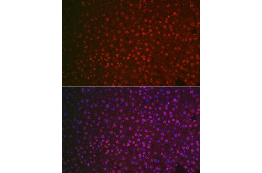 Immunofluorescence - Anti-NR5A2/LRH1 Antibody (A14961) - Antibodies.com