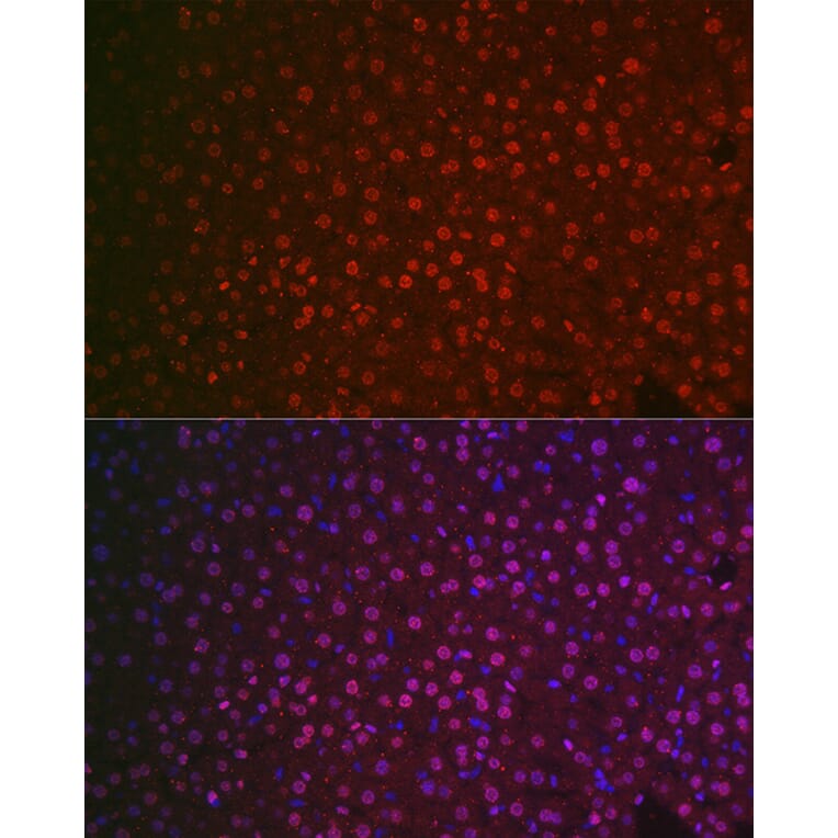 Immunofluorescence - Anti-NR5A2/LRH1 Antibody (A14961) - Antibodies.com