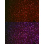 Immunofluorescence - Anti-NR5A2/LRH1 Antibody (A14961) - Antibodies.com