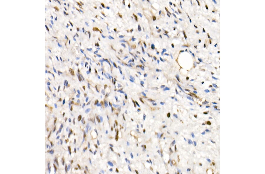 Immunohistochemistry - Anti-SNF5/SMARCB1 Antibody (A14962) - Antibodies.com