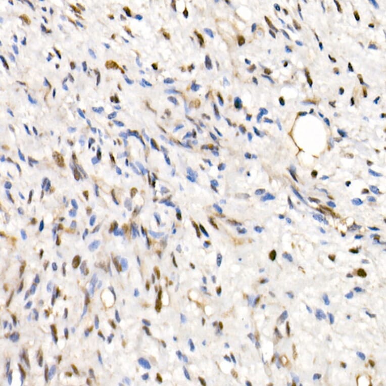 Immunohistochemistry - Anti-SNF5/SMARCB1 Antibody (A14962) - Antibodies.com