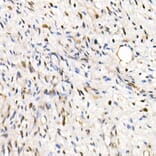 Immunohistochemistry - Anti-SNF5/SMARCB1 Antibody (A14962) - Antibodies.com