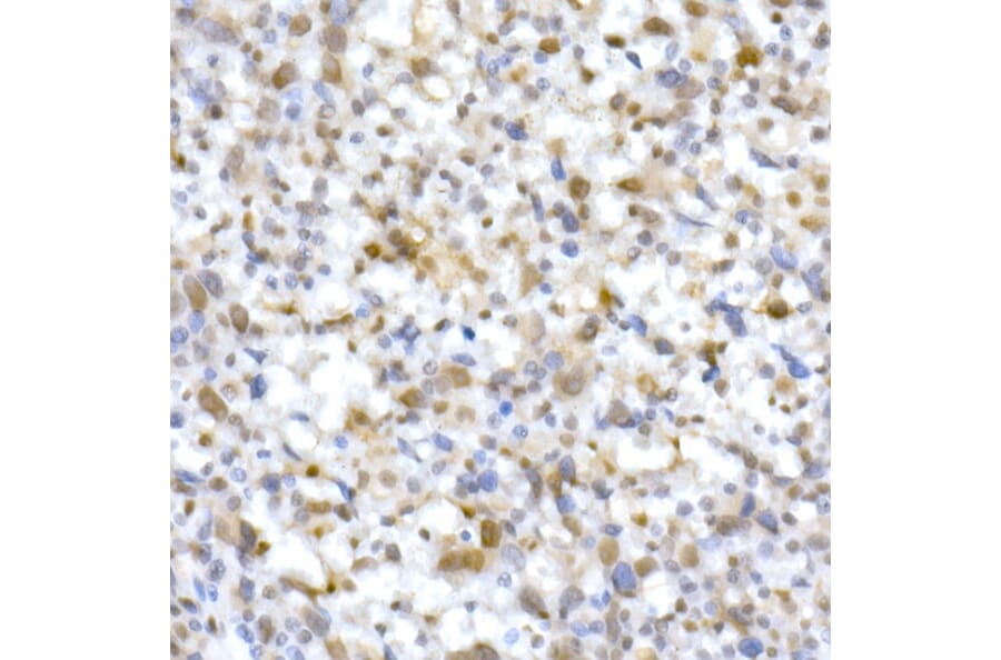 Immunohistochemistry - Anti-SNF5/SMARCB1 Antibody (A14962) - Antibodies.com