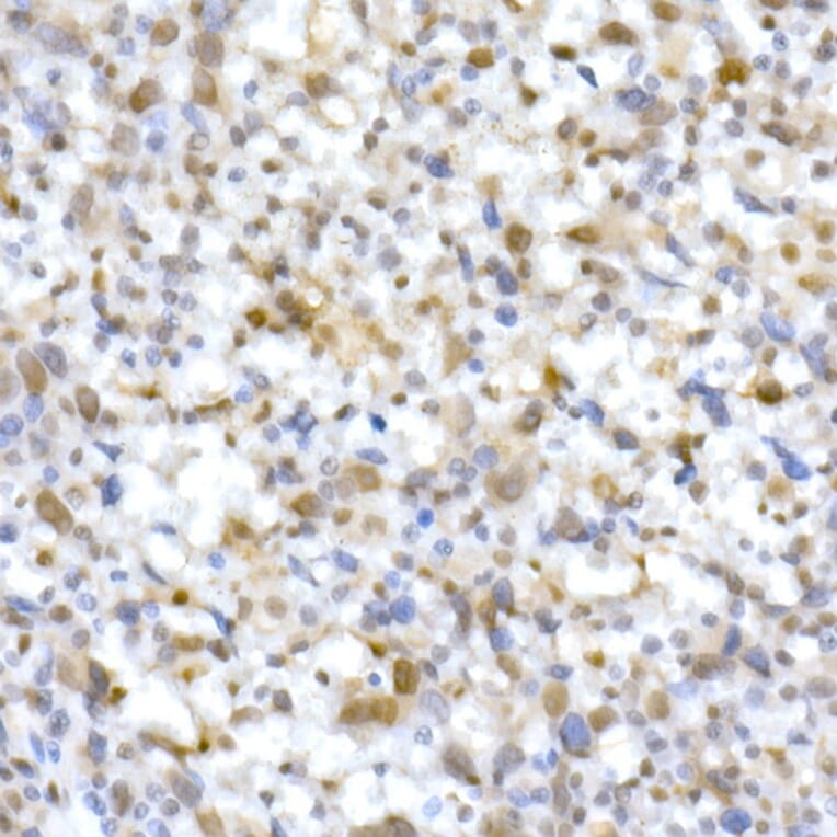 Immunohistochemistry - Anti-SNF5/SMARCB1 Antibody (A14962) - Antibodies.com