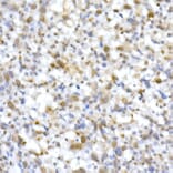 Immunohistochemistry - Anti-SNF5/SMARCB1 Antibody (A14962) - Antibodies.com