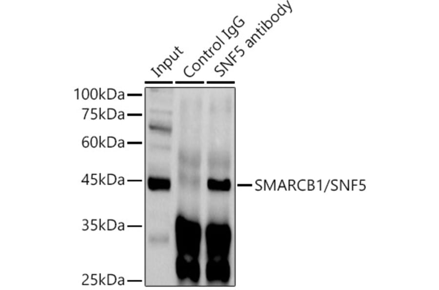 Western Blot - Anti-SNF5/SMARCB1 Antibody (A14962) - Antibodies.com
