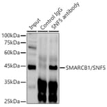 Western Blot - Anti-SNF5/SMARCB1 Antibody (A14962) - Antibodies.com