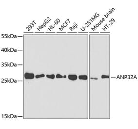 Western Blot - Anti-PHAP1 Antibody (A14963) - Antibodies.com