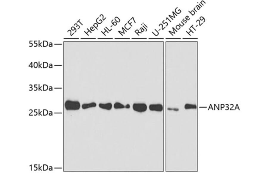 Western Blot - Anti-PHAP1 Antibody (A14963) - Antibodies.com