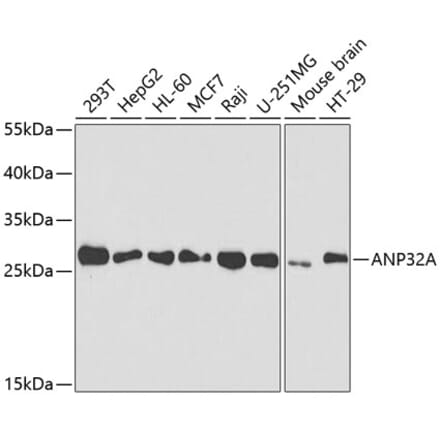 Western Blot - Anti-PHAP1 Antibody (A14963) - Antibodies.com