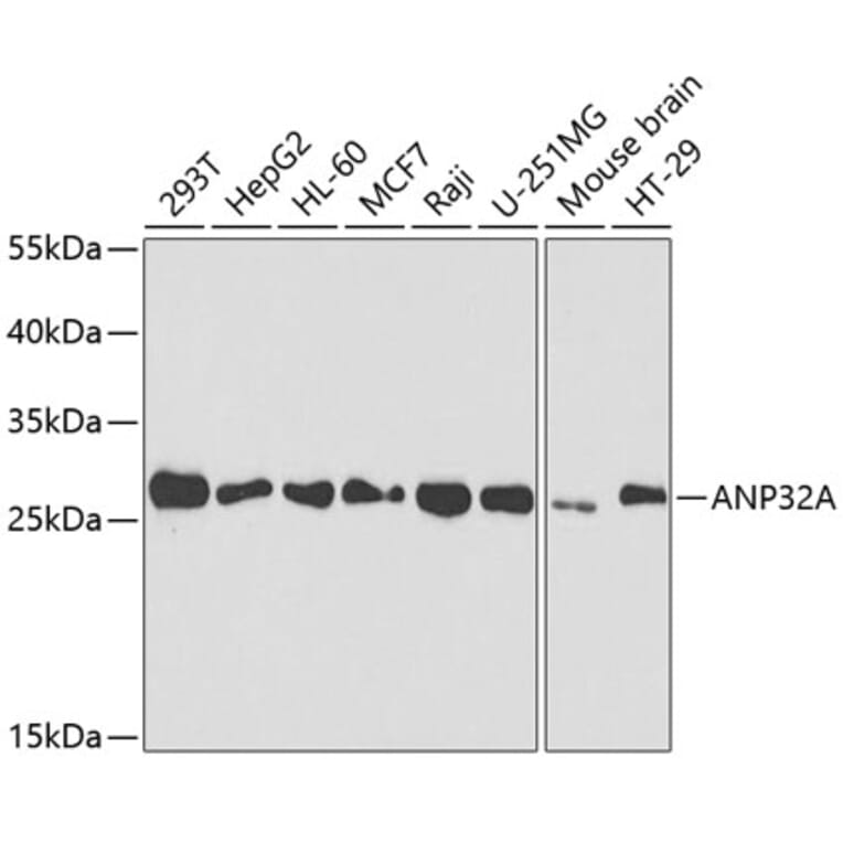 Western Blot - Anti-PHAP1 Antibody (A14963) - Antibodies.com