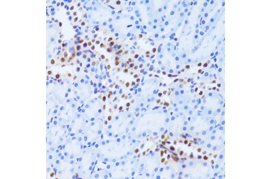 Immunohistochemistry - Anti-PHAP1 Antibody (A14963) - Antibodies.com