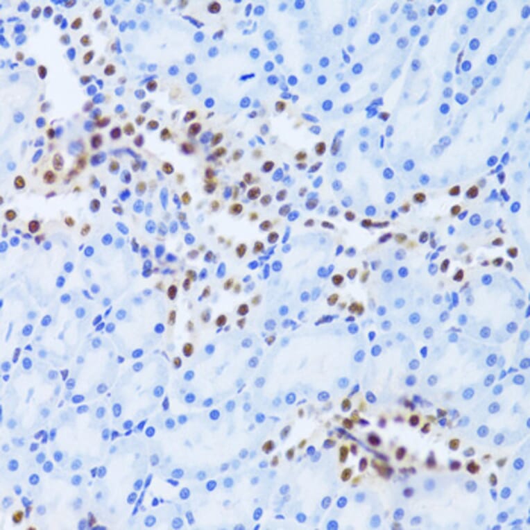 Immunohistochemistry - Anti-PHAP1 Antibody (A14963) - Antibodies.com