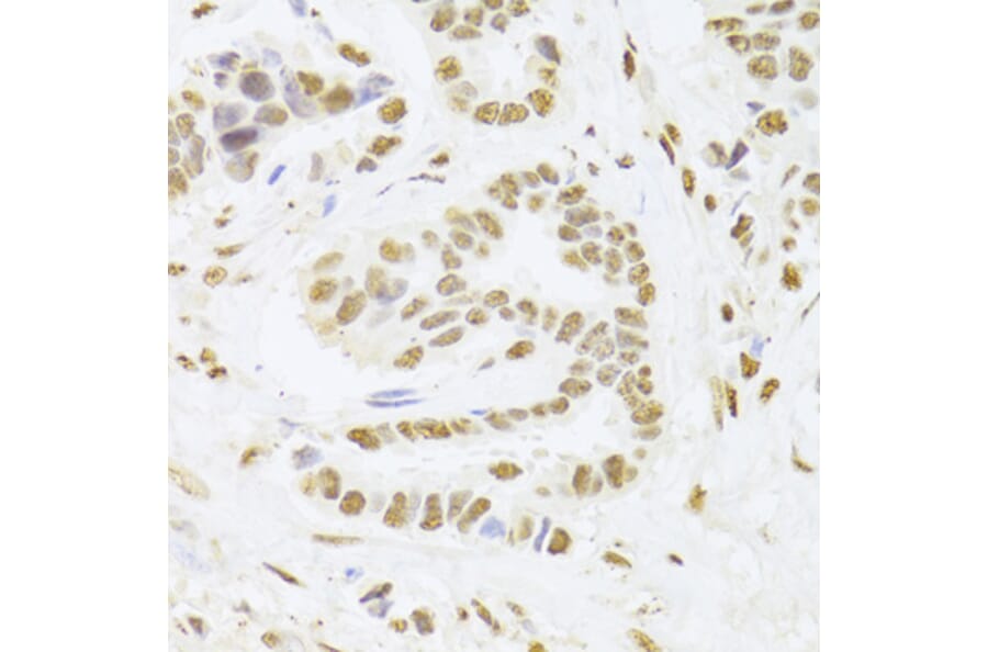 Immunohistochemistry - Anti-PHAP1 Antibody (A14963) - Antibodies.com