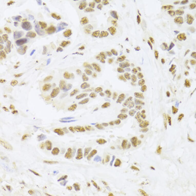 Immunohistochemistry - Anti-PHAP1 Antibody (A14963) - Antibodies.com