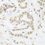 Immunohistochemistry - Anti-PHAP1 Antibody (A14963) - Antibodies.com