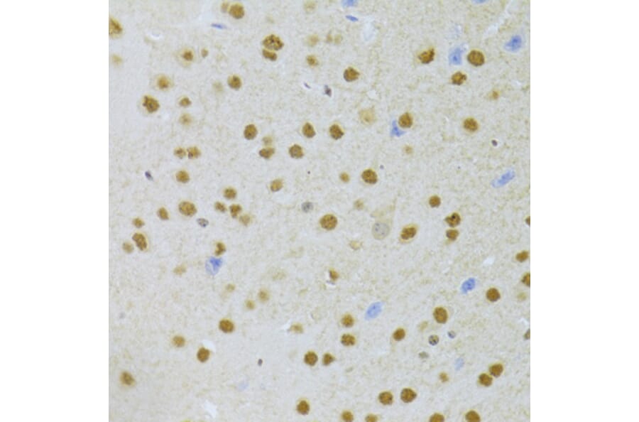 Immunohistochemistry - Anti-PHAP1 Antibody (A14963) - Antibodies.com