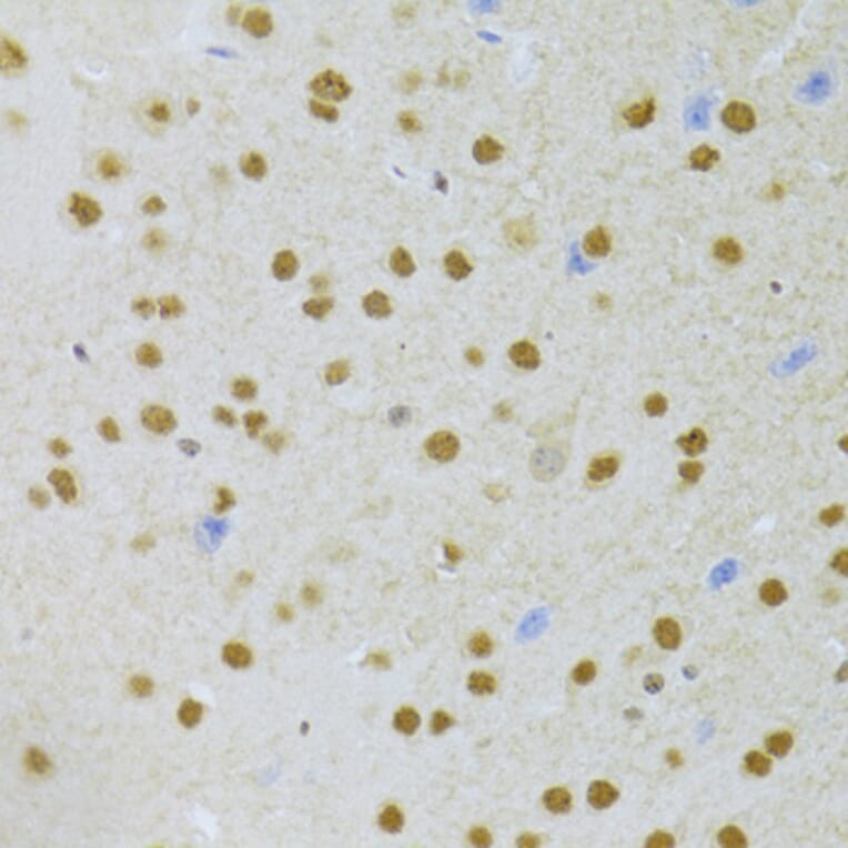 Immunohistochemistry - Anti-PHAP1 Antibody (A14963) - Antibodies.com