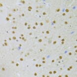 Immunohistochemistry - Anti-PHAP1 Antibody (A14963) - Antibodies.com