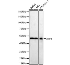 Western Blot - Anti-ATPB Antibody (A14964) - Antibodies.com