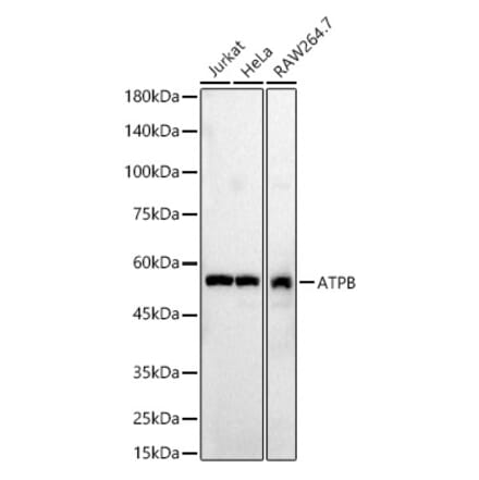 Western Blot - Anti-ATPB Antibody (A14964) - Antibodies.com