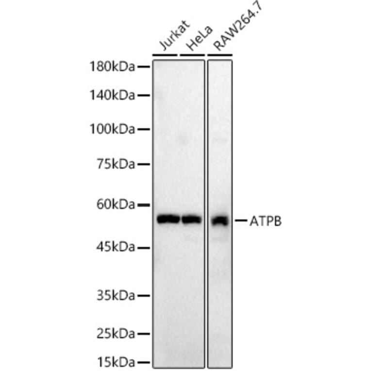 Western Blot - Anti-ATPB Antibody (A14964) - Antibodies.com