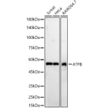 Western Blot - Anti-ATPB Antibody (A14964) - Antibodies.com