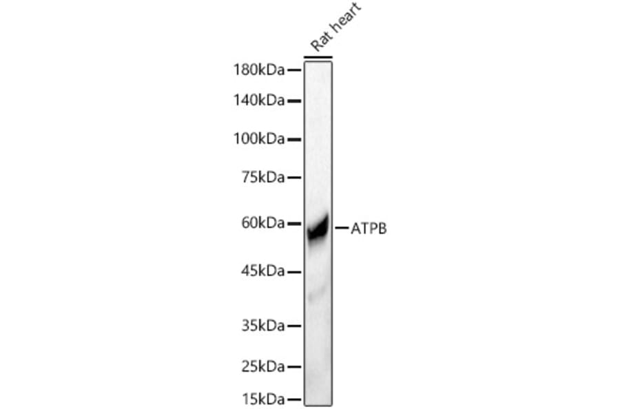 Western Blot - Anti-ATPB Antibody (A14964) - Antibodies.com