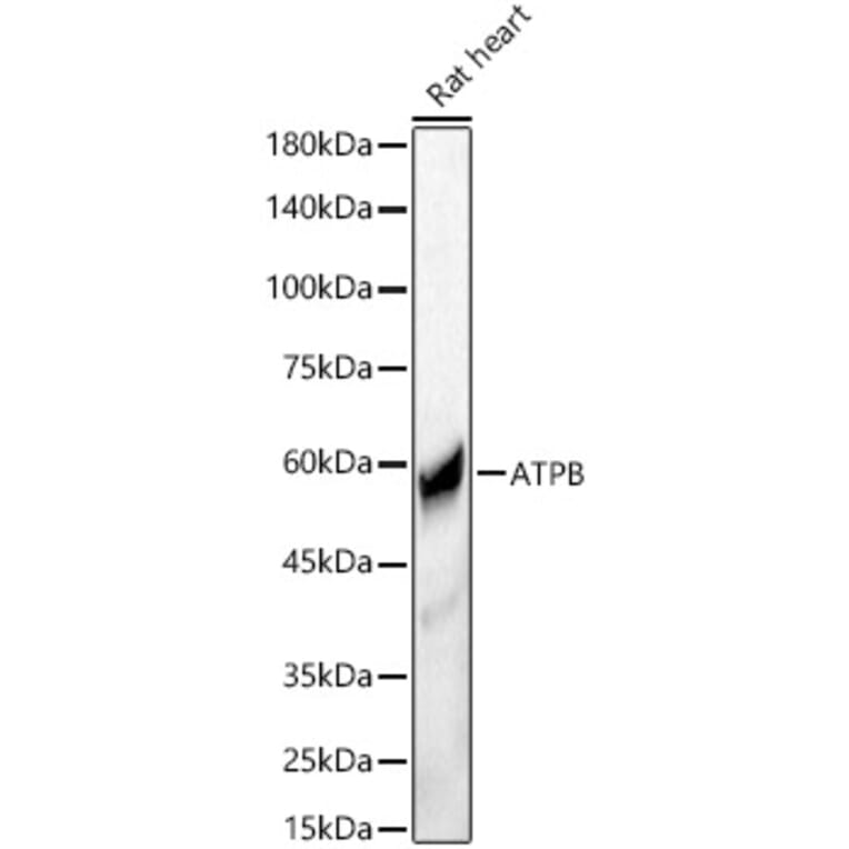 Western Blot - Anti-ATPB Antibody (A14964) - Antibodies.com