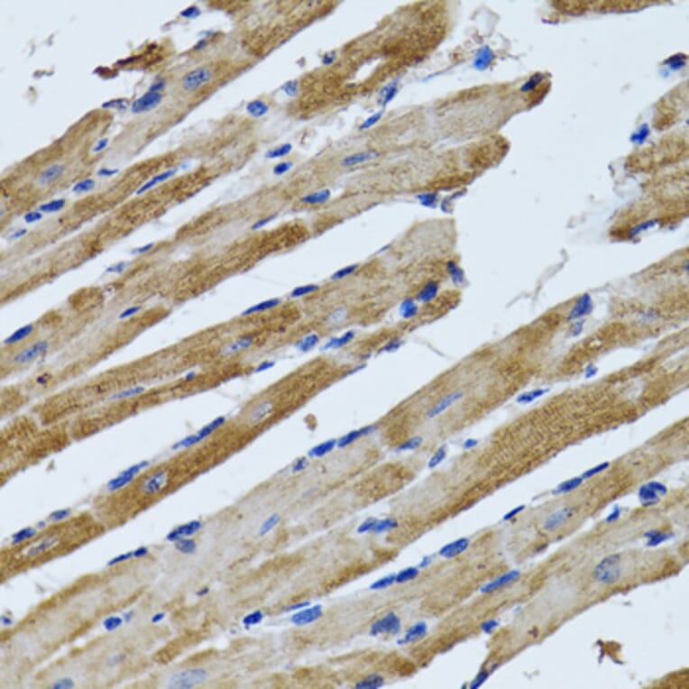 Immunohistochemistry - Anti-ATPB Antibody (A14964) - Antibodies.com