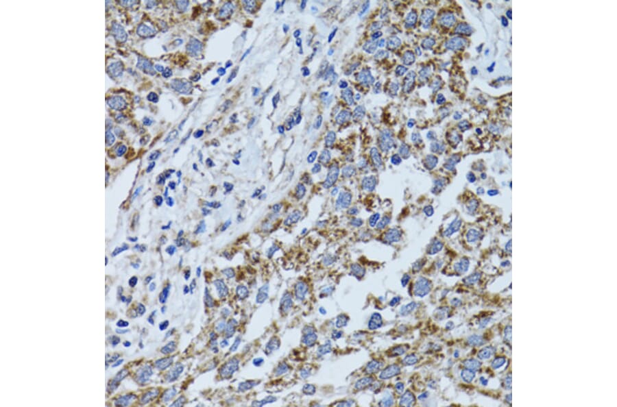 Immunohistochemistry - Anti-ATPB Antibody (A14964) - Antibodies.com