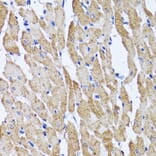 Immunohistochemistry - Anti-ATPB Antibody (A14964) - Antibodies.com