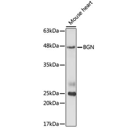 Western Blot - Anti-Biglycan Antibody (A14965) - Antibodies.com