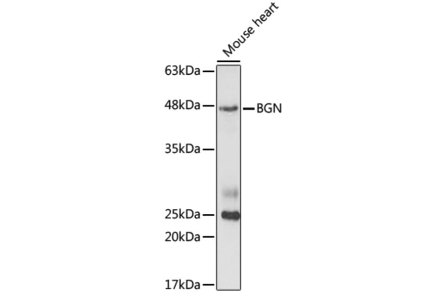 Western Blot - Anti-Biglycan Antibody (A14965) - Antibodies.com