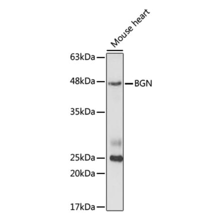 Western Blot - Anti-Biglycan Antibody (A14965) - Antibodies.com