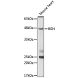 Western Blot - Anti-Biglycan Antibody (A14965) - Antibodies.com