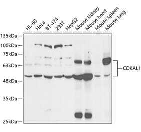 Western Blot - Anti-CDKAL1 Antibody (A14966) - Antibodies.com