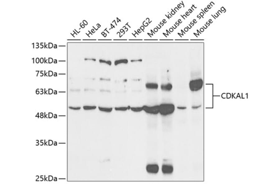 Western Blot - Anti-CDKAL1 Antibody (A14966) - Antibodies.com
