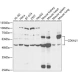 Western Blot - Anti-CDKAL1 Antibody (A14966) - Antibodies.com