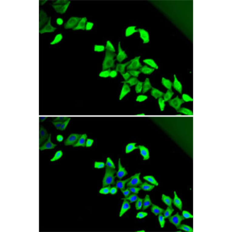 Immunofluorescence - Anti-CDKAL1 Antibody (A14966) - Antibodies.com