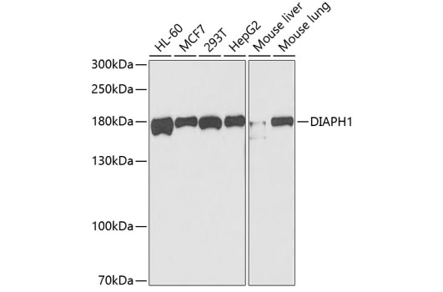 Western Blot - Anti-DIAPH1 Antibody (A5772) - Antibodies.com