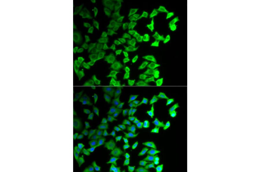 Immunofluorescence - Anti-DIAPH1 Antibody (A5772) - Antibodies.com