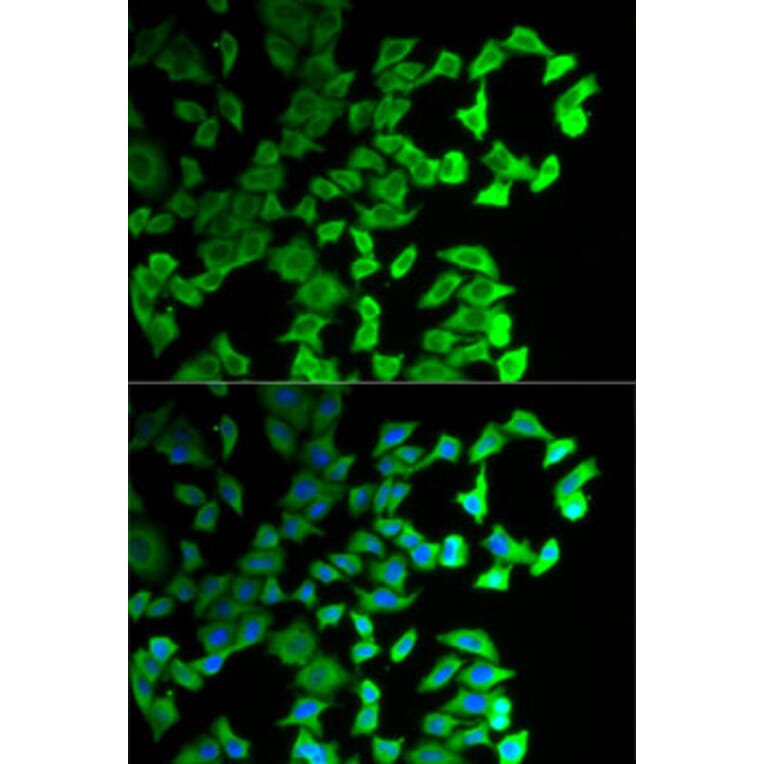 Immunofluorescence - Anti-DIAPH1 Antibody (A5772) - Antibodies.com