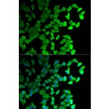 Immunofluorescence - Anti-DIAPH1 Antibody (A5772) - Antibodies.com