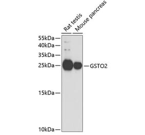 Western Blot - Anti-GSTO2 Antibody (A14968) - Antibodies.com
