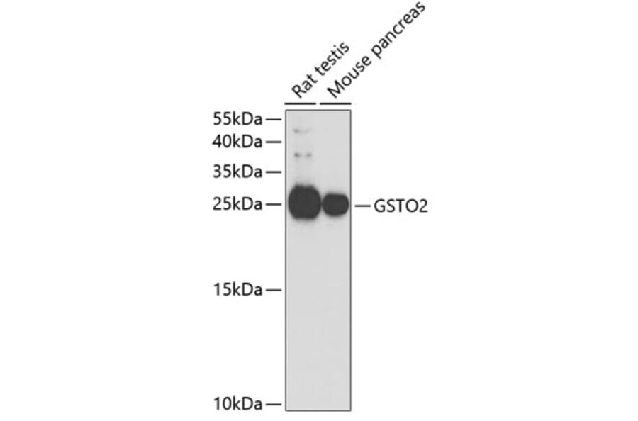 Western Blot - Anti-GSTO2 Antibody (A14968) - Antibodies.com
