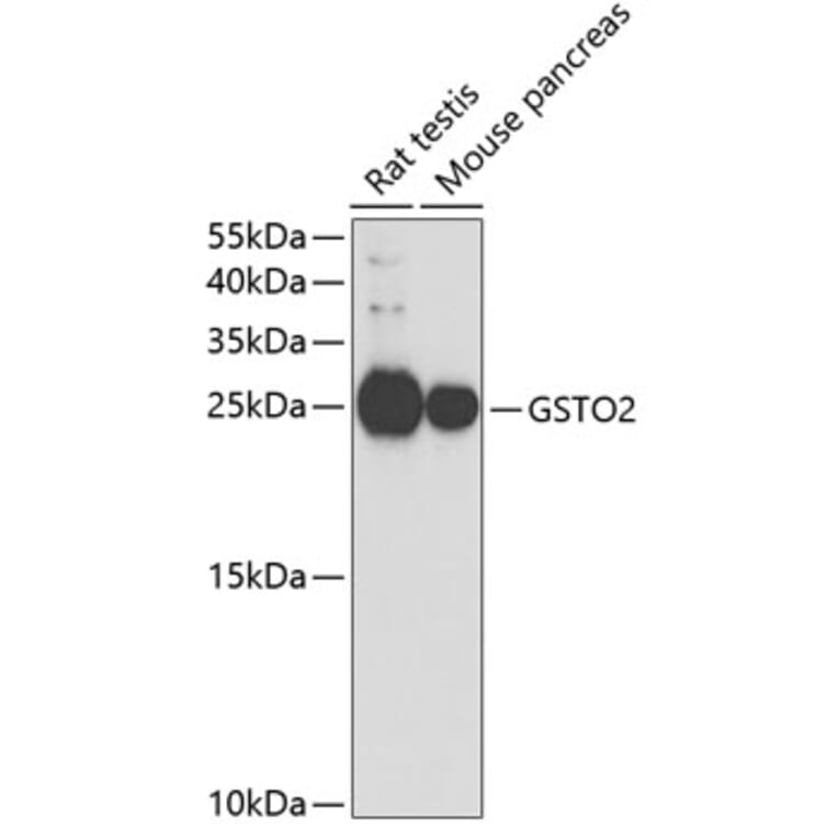 Western Blot - Anti-GSTO2 Antibody (A14968) - Antibodies.com