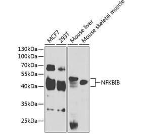 Western Blot - Anti-IKB beta Antibody (A14970) - Antibodies.com