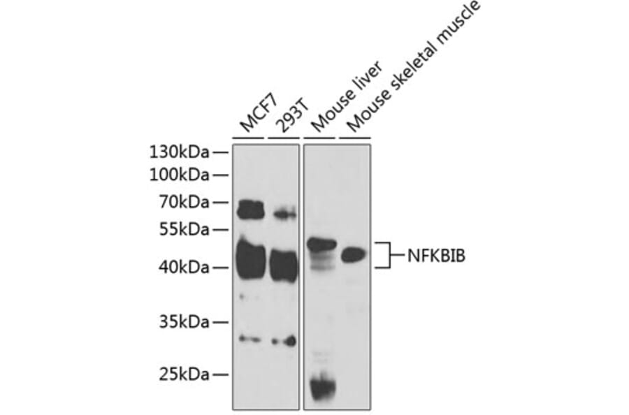 Western Blot - Anti-IKB beta Antibody (A14970) - Antibodies.com